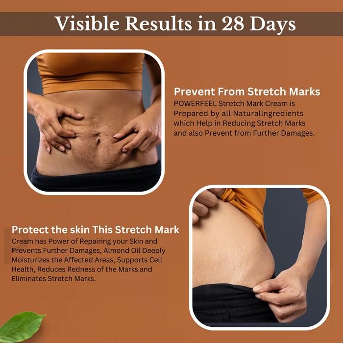 Natural Stretch Marks Cream 50g